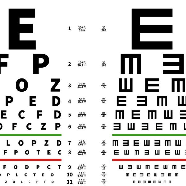 حروف معاینه چشم - بینایی سنجی نور